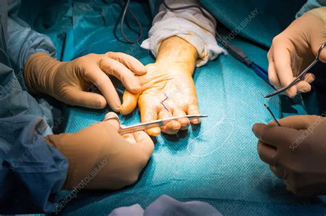 Hand surgery - Stock Image - C034/9750 - Science Photo Library