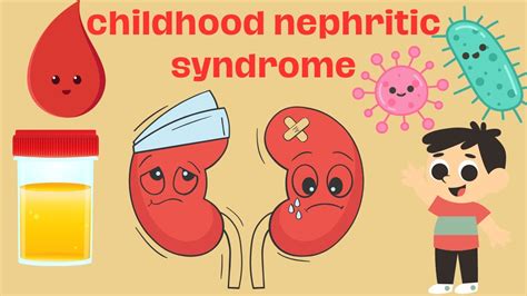 Childhood Nephritic Syndrome Pathogenesis Signs, Symptoms, and Treatment In a Simplified Way ...