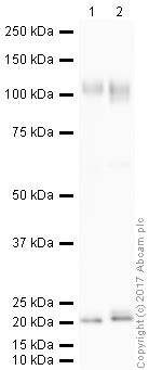 Anti-LAMP1 antibody - Lysosome Marker (ab24170) | Abcam