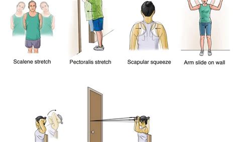 13 Best Exercise for Thoracic Outlet Syndrome - Samarpan Physio