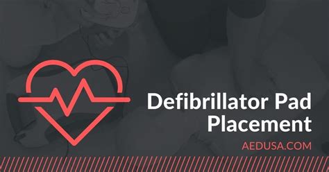 Defibrillator Pad Placement - Where Do Electrode Pads Go?