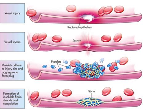 Hemostasis Flashcards | Quizlet