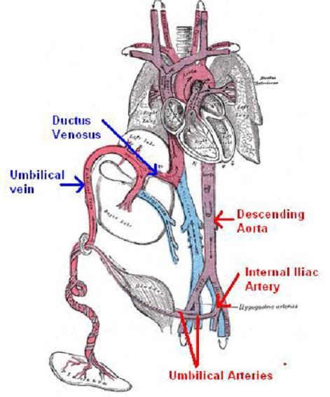 Umbilical catheters