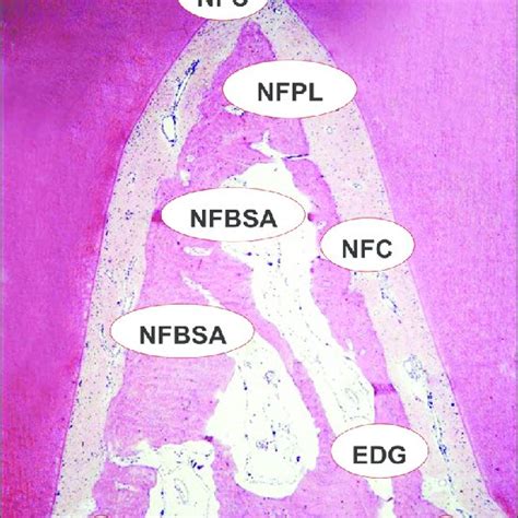 Surgical phase group II (Bio-Oss bone graft alone) | Download Scientific Diagram