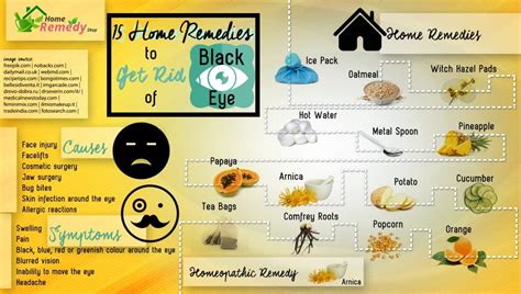 15 Home Remedies to Get Rid of Black Eye + Infographic - Home Remedies