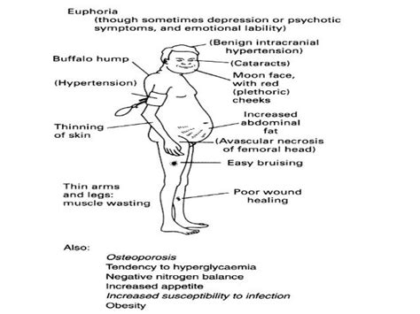 topical corticosteroid side effects - pictures, photos