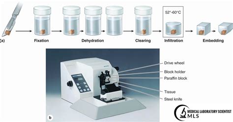 Tissue Processing : Factors, Steps Of Tissue Processing, Types