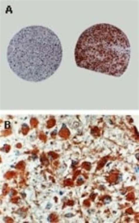 anti-active/cleaved Caspase 8, Polyclonal, Novus Biologicals 0.025mL; Unlabeled:Antibodies ...