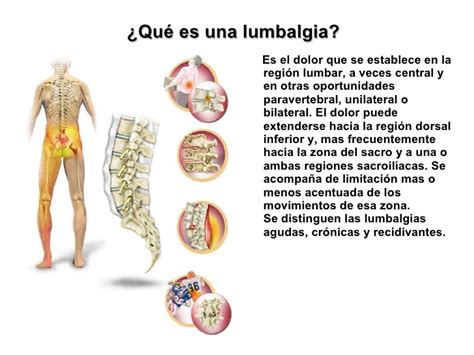 Lumbalgia - Escuelapedia - Recursos EducativosEscuelapedia – Recursos educativos