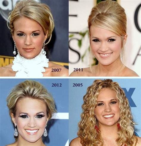 Carrie Underwood Plastic Surgery Before And After Photos - CelebLens.Com