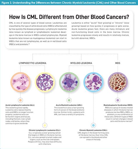 Conquer: the journey informed - Resistant Chronic Myeloid Leukemia: Starting Over Again