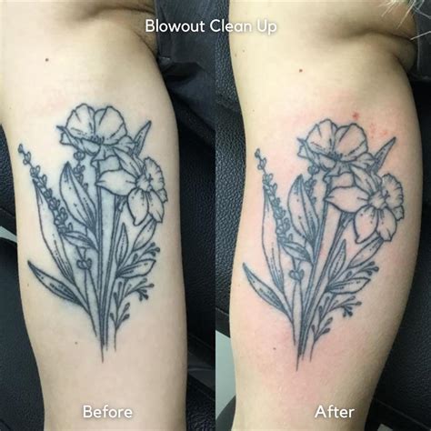 How Do You Fix a Tattoo Blowout? - Hero Tattoo