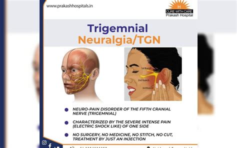 Trigeminal Neuralgia Treatment