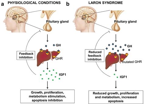 Clinical and Molecular Features of Laron Syndrome, A Genetic Disorder Protecting from Cancer ...