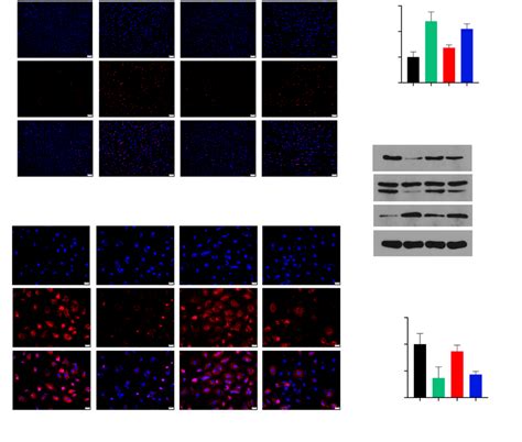 Aerobic exercise decreased apoptosis and increased autophagy in rats... | Download Scientific ...