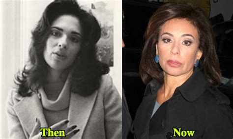 Jeanine Pirro Plastic Surgery: Botox, Facelift, Cheek Fillers, Lip Fillers