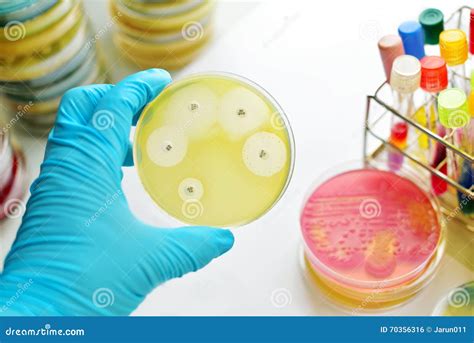 Antimicrobial Susceptibility Testing Stock Photo - Image of colonies ...