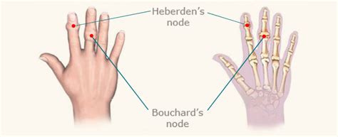 Finger Nodes