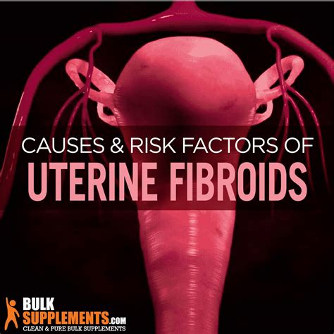 What are Uterine Fibroids? Symptoms, Causes & Treatment