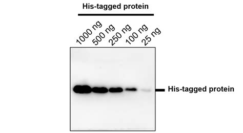 His tag antibody (IRT002) | iReal Biotechnology, Inc.