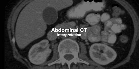 Abdominal CT: Phases • LITFL • Radiology library