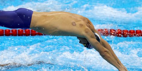 Does Cupping Really Give Michael Phelps an Edge? | Inverse