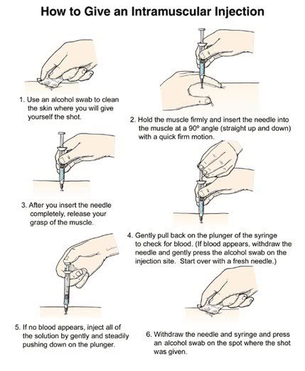 Intramuscular injection "IM" sites,steps,procedure