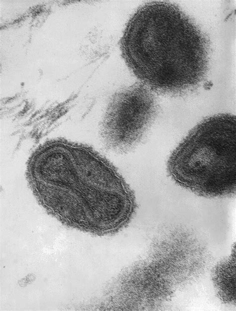 Have scientists just gifted bio-terrorists a doomsday smallpox virus?