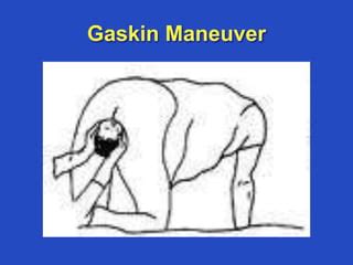 Gaskin Maneuver