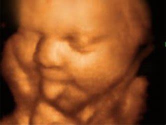 3d Ultrasound Pictures Pregnancy :: 3d Puzzle Image