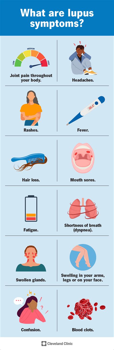 Lupus: Symptoms & Treatment