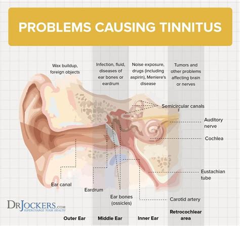 Tinnitus: Symptoms, Causes and Natural Support Strategies | Tinnitus remedies, Tinnitus symptoms ...