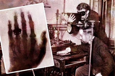 How X-rays were discovered in the 1890s - momentous Victorian medical ...