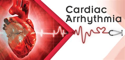 Research On Arrhythmia Could Reduce The Risk Of Sudden Cardiac Death ...