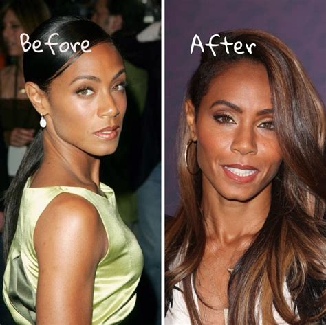 Jada Pinkett Smith Plastic Surgery. Did she had to do it?