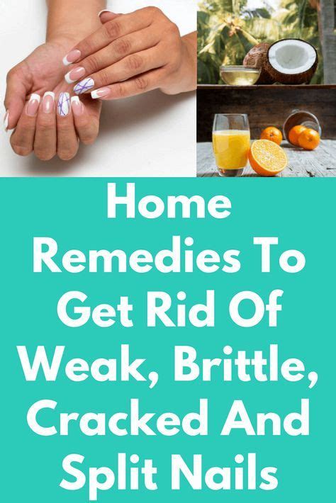 Home Remedies To Get Rid Of Weak, Brittle, Cracked And Split Nails ...