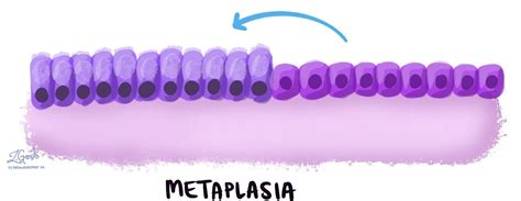 化生 | MyPathologyReport.ca