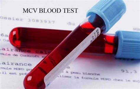 Your MCV Blood Test is Too High or Too Low - What Does That Mean?