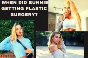 Bunnie Xo Before Plastic Surgery Her Looks Now And Then!