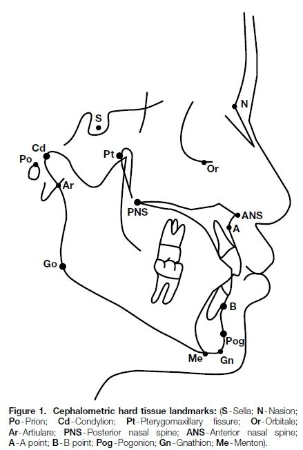 Cephalometric analysis: manual tracing of a lateral cephalogram