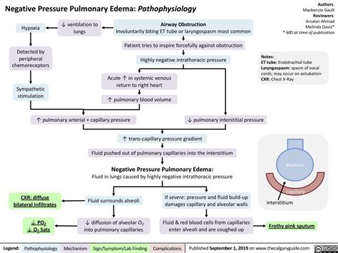 Negative Pressure Pulmonary Edema: Pathophysiology | Calgary Guide