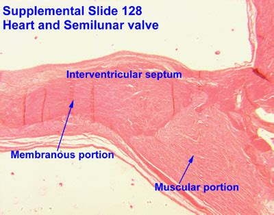 Interventricular septum - Wikipedia