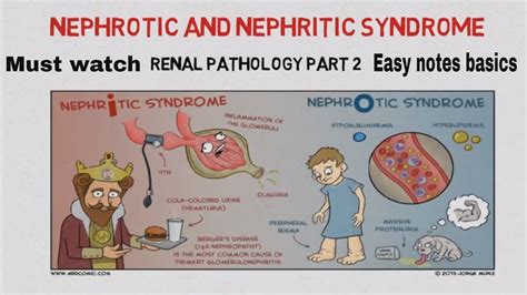 Nephrotic and nephritic syndrome - Causes , introduction EASY NOTES ...