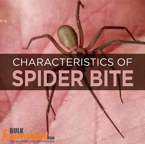 Spider Bite. Effective Treatment & Supplements for Spider Bites