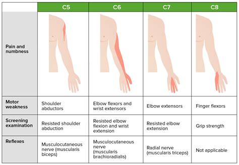 Cervical Herniated Disc Dermatomes - Dermatomes Chart and Map