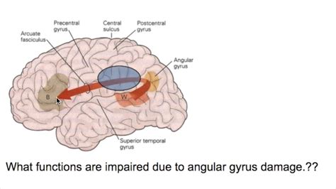 PROSOPAGNOSIA( Face blindness)/ANGULAR GYRUS LESIONS - YouTube