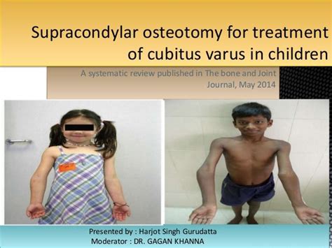 Supracondylar osteotomy for treatment of cubitus varus