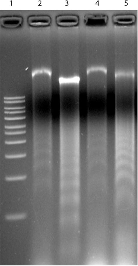 A DNA fragmentation assay for Dox titration was conducted to determine ...