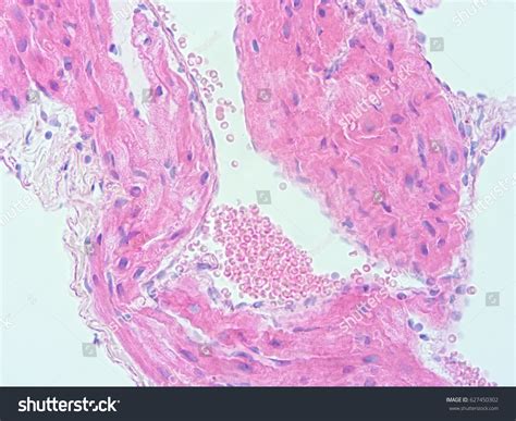 Histology Human Heart Show Cardiac Tissue Stock Photo 627450302 | Shutterstock