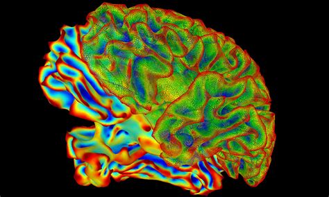 An experimental neurofeedback imaging treatment has emerged for psychiatric patients. Does it work?